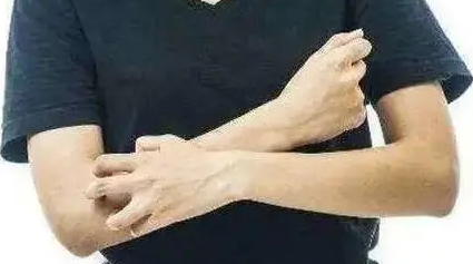 齐齐哈尔皮肤瘙痒是哪里能治